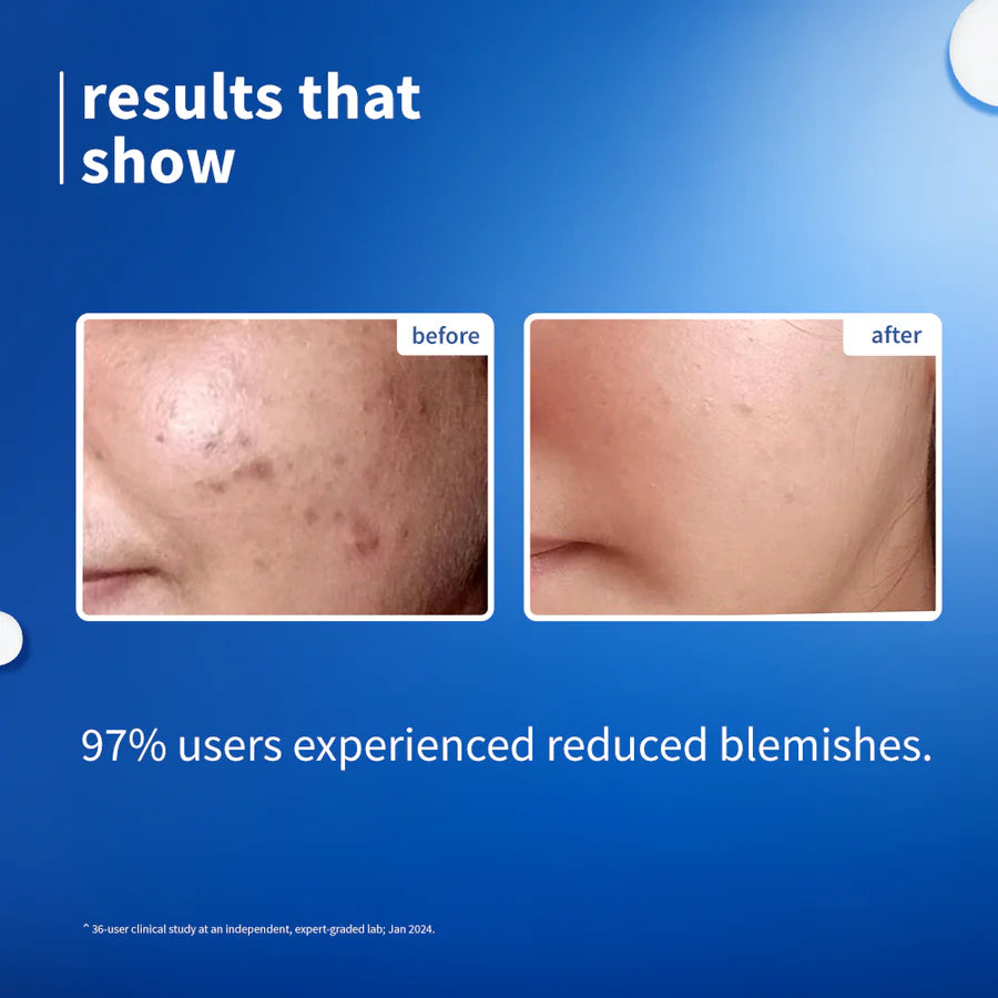 Plum 10% Niacinamide &amp; Rice Water Brightening Face Serum – Clear, Even &amp; Radiant Skin